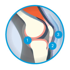 Joint Chart Image